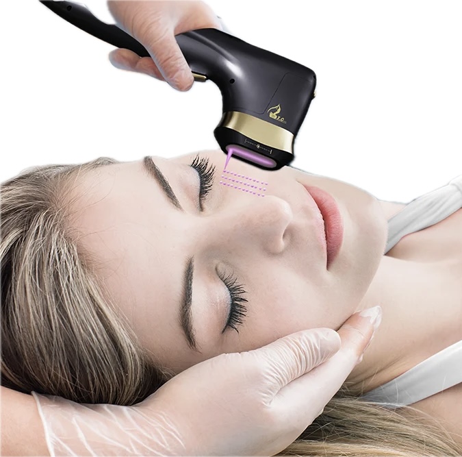 HIFU Face and body Bristol Skin tightening fat loss